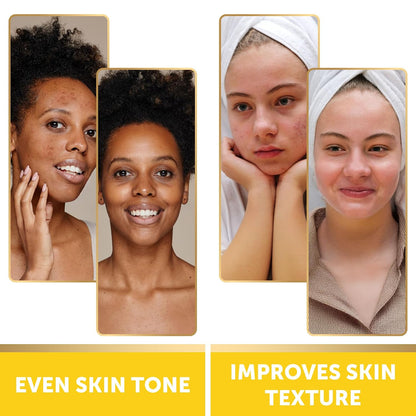 VALITIC Turmeric and Kojic Acid Cleansing Pads for Dark Spots 60 Units
