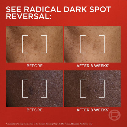 L'Oreal Paris Revitalift Triple Power Dark Spot Corrector Creamy-Serum, Hyperpigmentation Treatment With Melasyl, Vitamin C & Niacinamide, Treats Sun Spots, Dark Spots, Aging & Uneven Tone, 1.7 fl oz