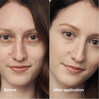 Clinique Even Better Clinical Serum Full Coverage Hydrating Foundation Broad Spectrum SPF 25 With Vitamin C, Salicylic Acid + Hyaluronic Acid For Oily Skin Types