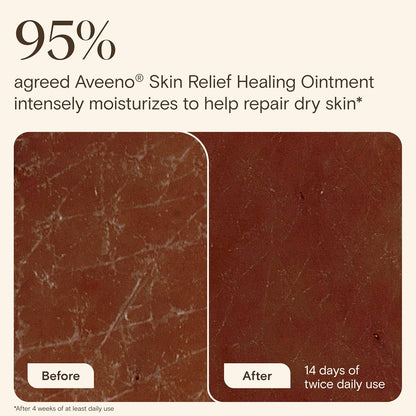 Aveeno Skin Relief Healing Ointment, Fragrance-Free, 7.2 oz