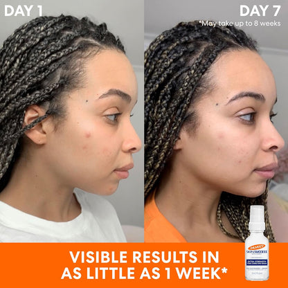 Palmer's Tone Correcting Face Serum, Extra Strength Skin Success (1.0 Oz)