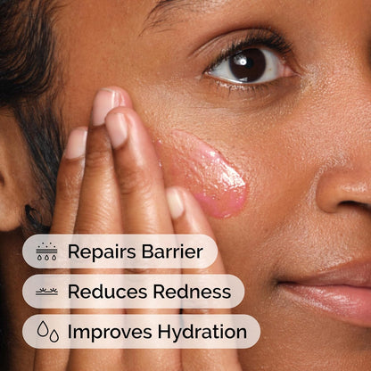 The Ordinary Soothing & Barrier Support Serum, Redness-Reducing & Hydrating Solution with Centella Asiatica for Skin Barrier Repair (Pack of 2)