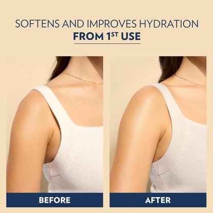 Vaseline Soothing Hydration Body Lotion Soothing Hydration for Dry Skin with Ultra-Hydrating Lipids + 1% Aloe Vera Extract to Refresh Dehydrated Skin 20.3 Fl oz