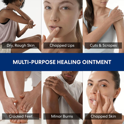Palmer's Cocoa Butter Formula Healing Ointment with Vitamin E, 3.75 Oz, Intensive Therapy for Severely Dry, Eczema Prone Skin, Provides 48-Hour Moisture, Non-Comedogenic, Dermatologist Approved