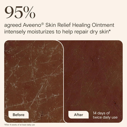 Aveeno Skin Relief Healing Ointment, Fragrance-Free, 2.0 oz