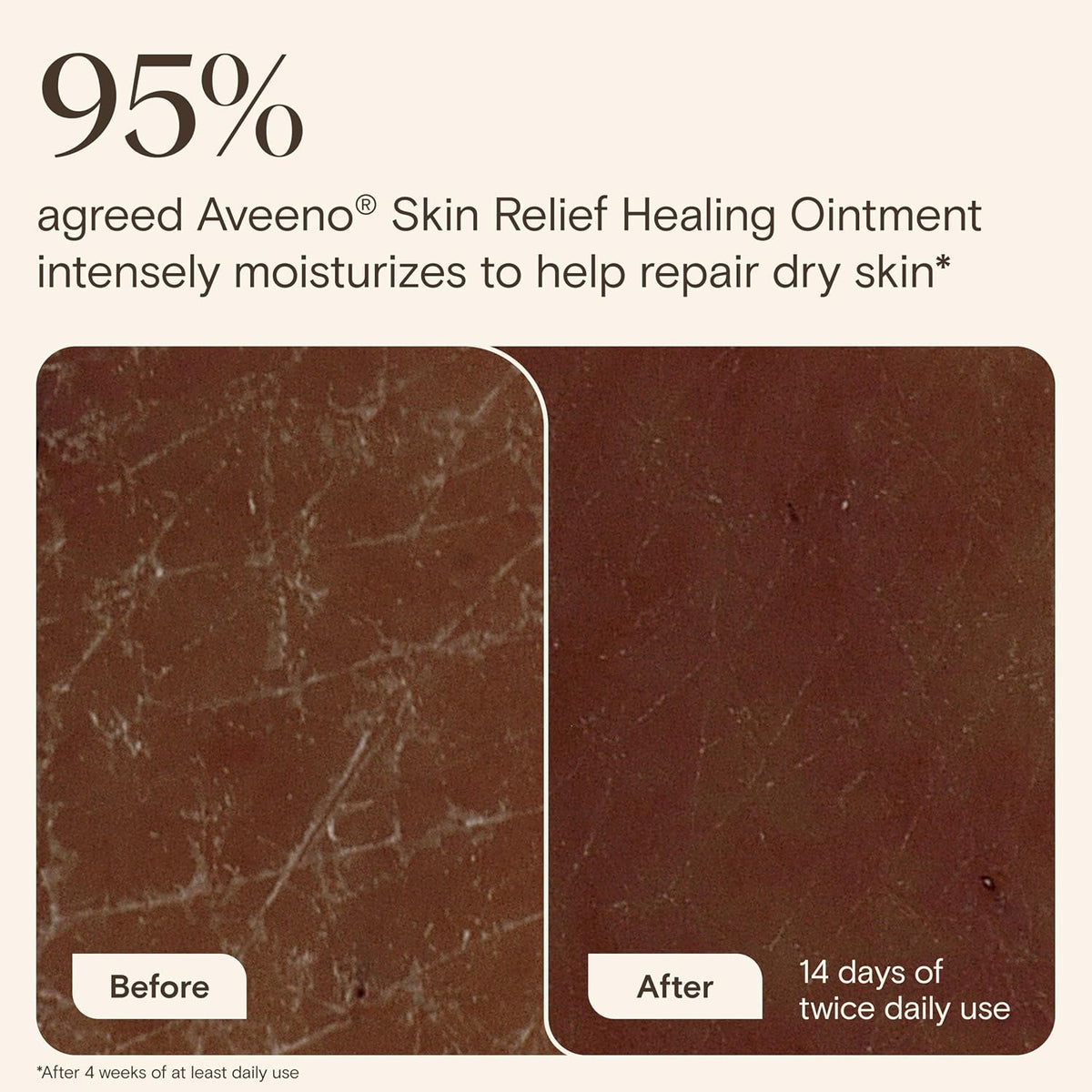 Aveeno Skin Relief Healing Ointment, Fragrance-Free, 2 Ounce (Pack of 12)