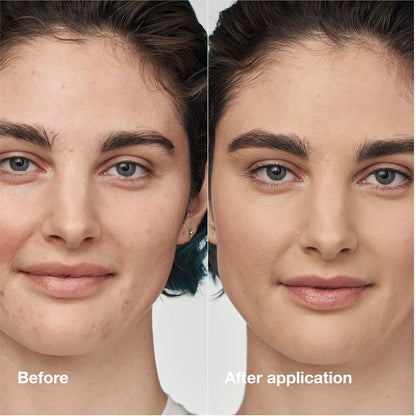 Clinique Even Better Clinical Serum Full Coverage Hydrating Foundation Broad Spectrum SPF 25 With Vitamin C, Salicylic Acid + Hyaluronic Acid For Oily Skin Types