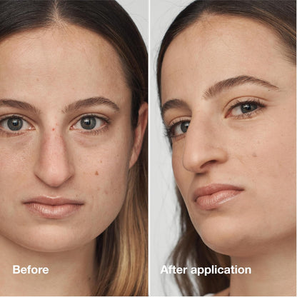 Clinique Even Better Clinical Serum Full Coverage Hydrating Foundation Broad Spectrum SPF 25 With Vitamin C, Salicylic Acid + Hyaluronic Acid For Oily Skin Types