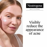 Neutrogena Rapid Clear Acne Spot Treatment, Benzoyl Peroxide 10% Pimple Cream, 1 oz
