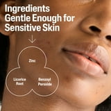 Cetaphil Gentle Clear Complexion-Clearing BPO Acne Cleanser for Sensitive Skin, 4.2 oz