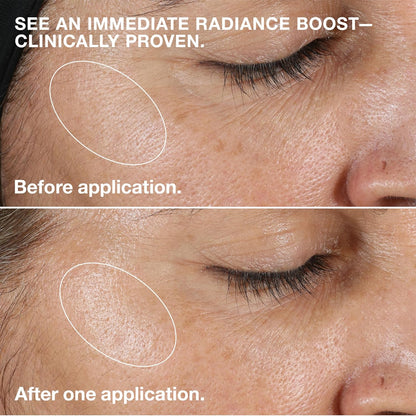 Clinique Clarifying Lotion 1.0, 1, 2, 3 & 4 | Exfoliating Face Toner with Witch Hazel | 5 Formulas for Every Skin Type | Step 2 of 3-Step Skin Care Routine
