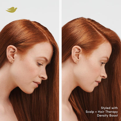 Dove Density Boost Strengthening Conditioner Scalp + Hair Therapy for protecting against premature breakage, with Vitamin B3, Zinc and 0% sulfates, 9.25 oz