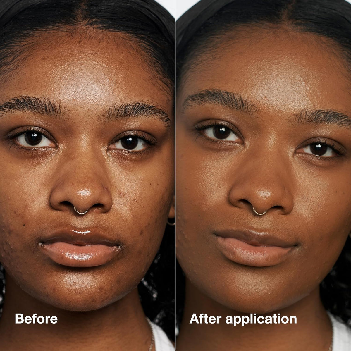 Clinique Even Better Makeup Liquid Foundation SPF 15 With Vitamin C For Dry + Oily Combination Skin Types | Medium Coverage + Natural Finish | Evens Skin Tone + Reduces Dark Spots