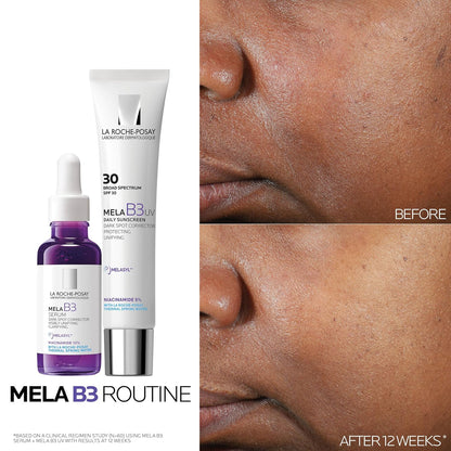 La Roche-Posay Mela B3 Niacinamide Serum, Anti-Aging Dark Spot Corrector