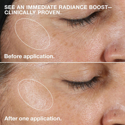 Clinique Clarifying Lotion 1.0, 1, 2, 3 & 4 | Exfoliating Face Toner with Witch Hazel | 5 Formulas for Every Skin Type | Step 2 of 3-Step Skin Care Routine