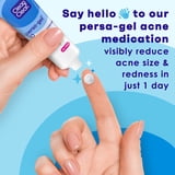 (2 pack) Clean & Clear Persa-Gel 10 Acne Treatment, Benzoyl Peroxide, 1 fl. oz