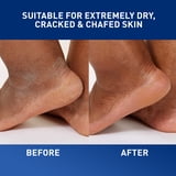 CeraVe Healing Ointment for Face & Body, Protects and Soothes Dry, Cracked, & Chafed Skin 12 oz