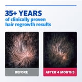 Men's Rogaine Extra Strength 5% Minoxidil Topical Solution, 1-Month