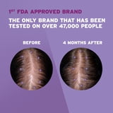 Women's Rogaine 2% Minoxidil Liquid Solution, 1-Month Supply