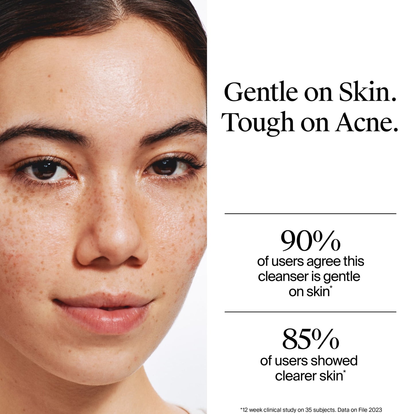 Neutrogena Oil-Free Acne Face Wash, Salicylic Acid Facial Cleanser & Acne Treatment, 9.1 fl oz