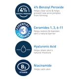 Cerave Acne Foaming Cream Cleanser with 4% Benzoyl Peroxide, Hyaluronic Acid, Niacinamide Cream-to-Foam Formula 5 fl oz